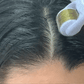 Derma Roller | Titanium Alloy Needles For Hair Growth