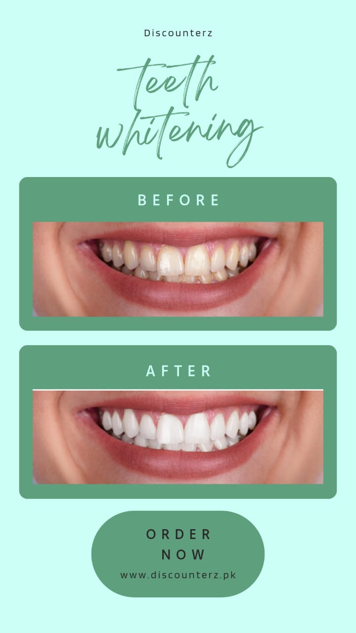 Teeth Whitening Powder