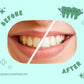 Teeth Whitening Powder